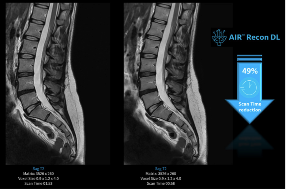 Jornada de IA y ecosistema digital en radiología: cómo ofrecer alta productividad con calidad de manera sostenible mejorando la experiencia del paciente en un servicio de radiología.